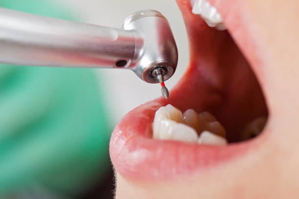 Best Emergency Gum Treatment in Churchville, PA